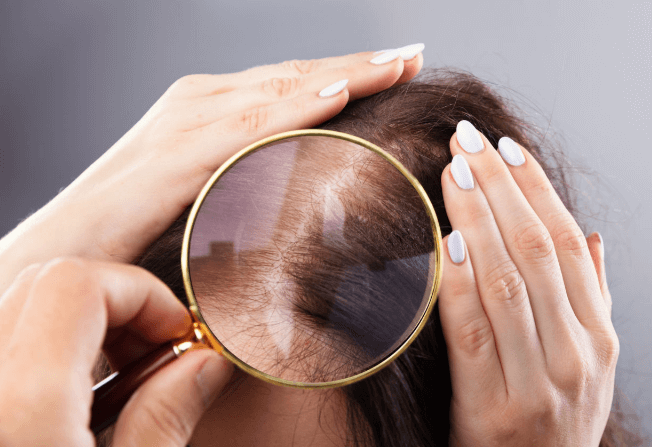 Hair Restoration in Fort Lauderdale | Hair loss treatment